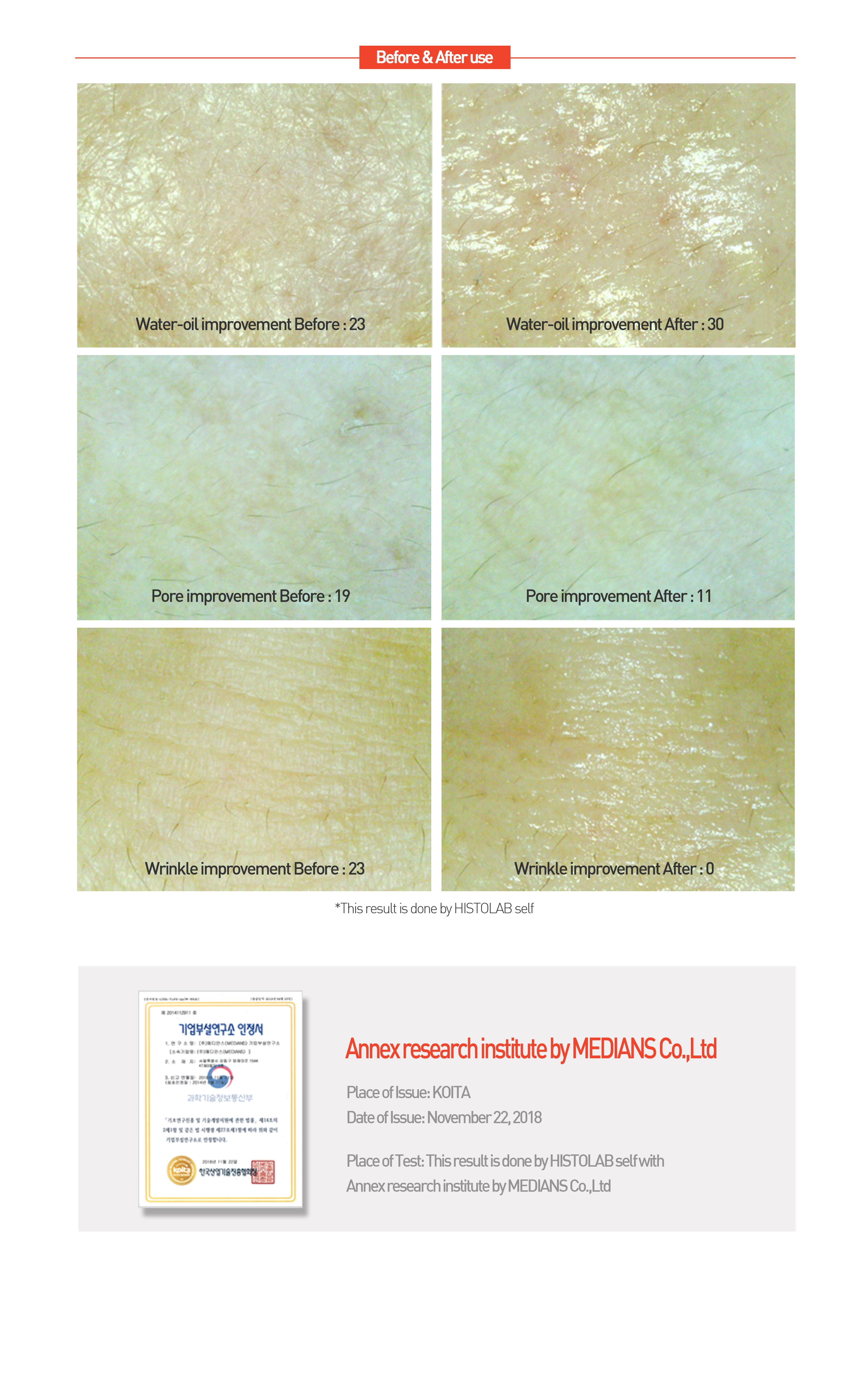 HYDROGEL REGENERATING CENTELLA CREAM (Sleeping Pack) - HistoLab Canada